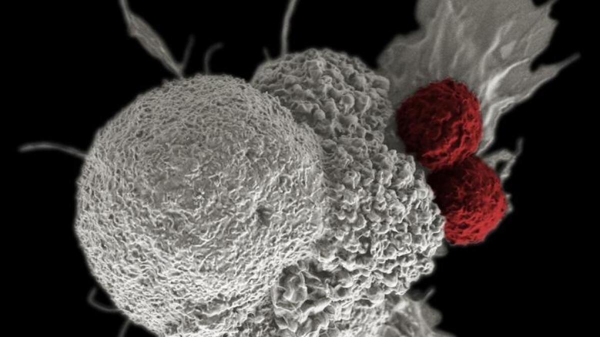 t-cells, cancer cure, TCR