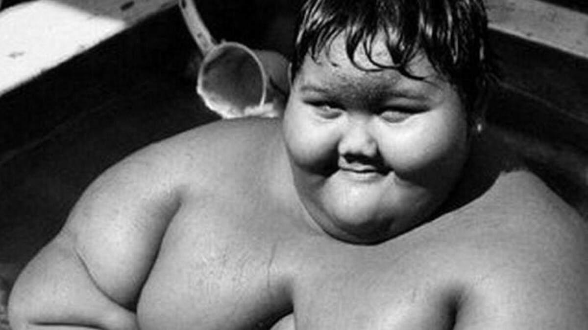 192kgs and only 10 years old: Meet worlds most obese boy 