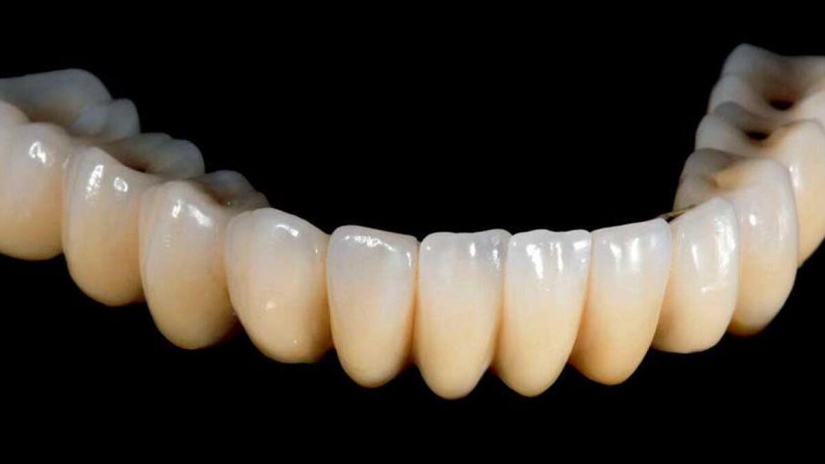 The dental framework was created in cobalt chrome last Thursday.