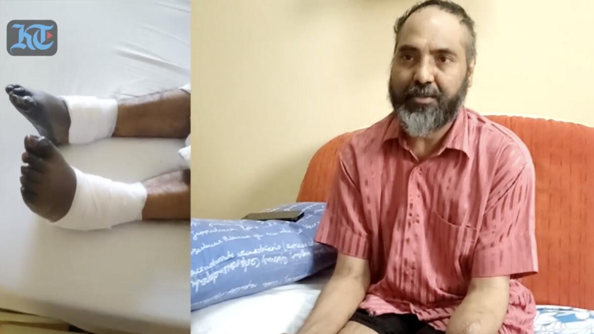 UAE-based Indian expat loses hands, feet after minor infection