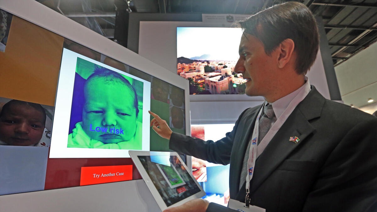 App to detect genetic conditions in babies
