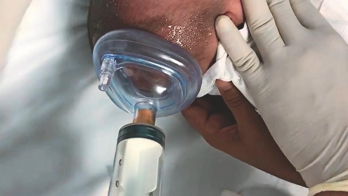 Doctors reshape injured babys skull sans surgery 