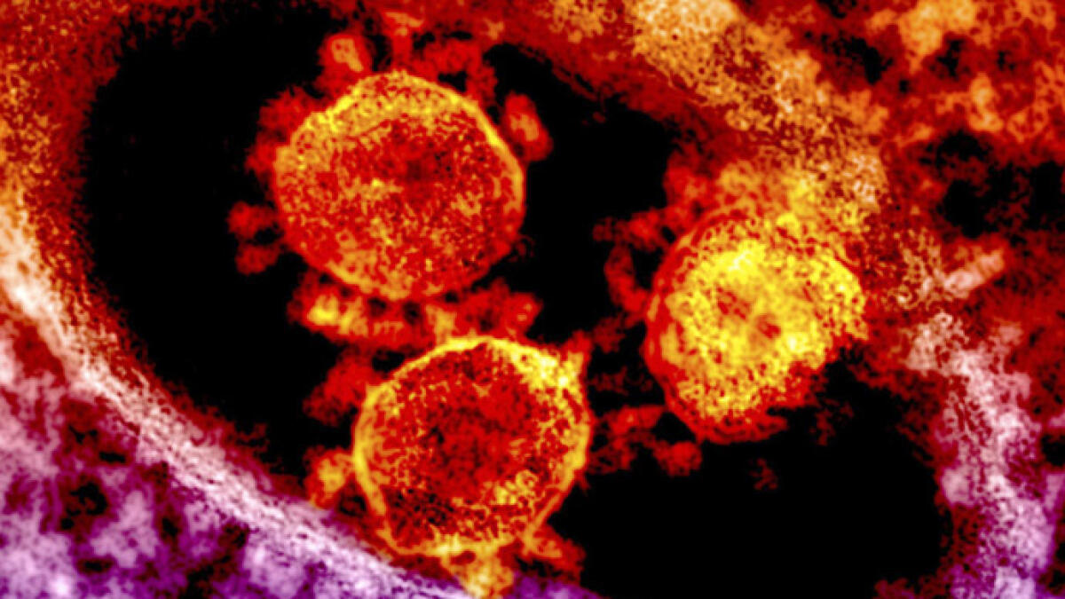 Particles of the Middle East respiratory syndrome (MERS) coronavirus that emerged in 2012.