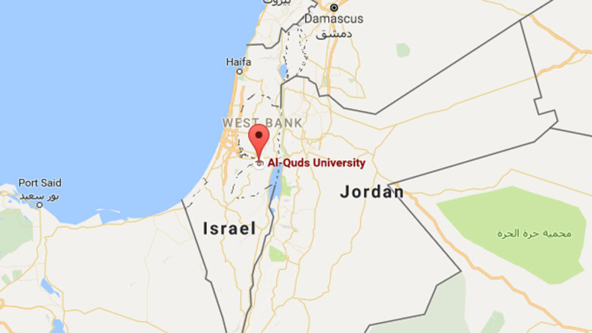 45 injured during Israeli raid
