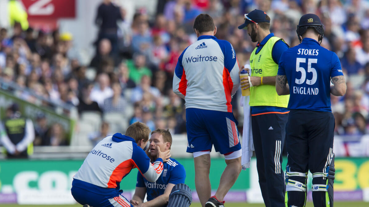 Englands captain Eoin Morgan, second left, is treated as he sits on the pitch after being hit on the head off a ball bowled by Australia Mitchell Starc during the deciding cricket match of the One Day International series between England and Australia at