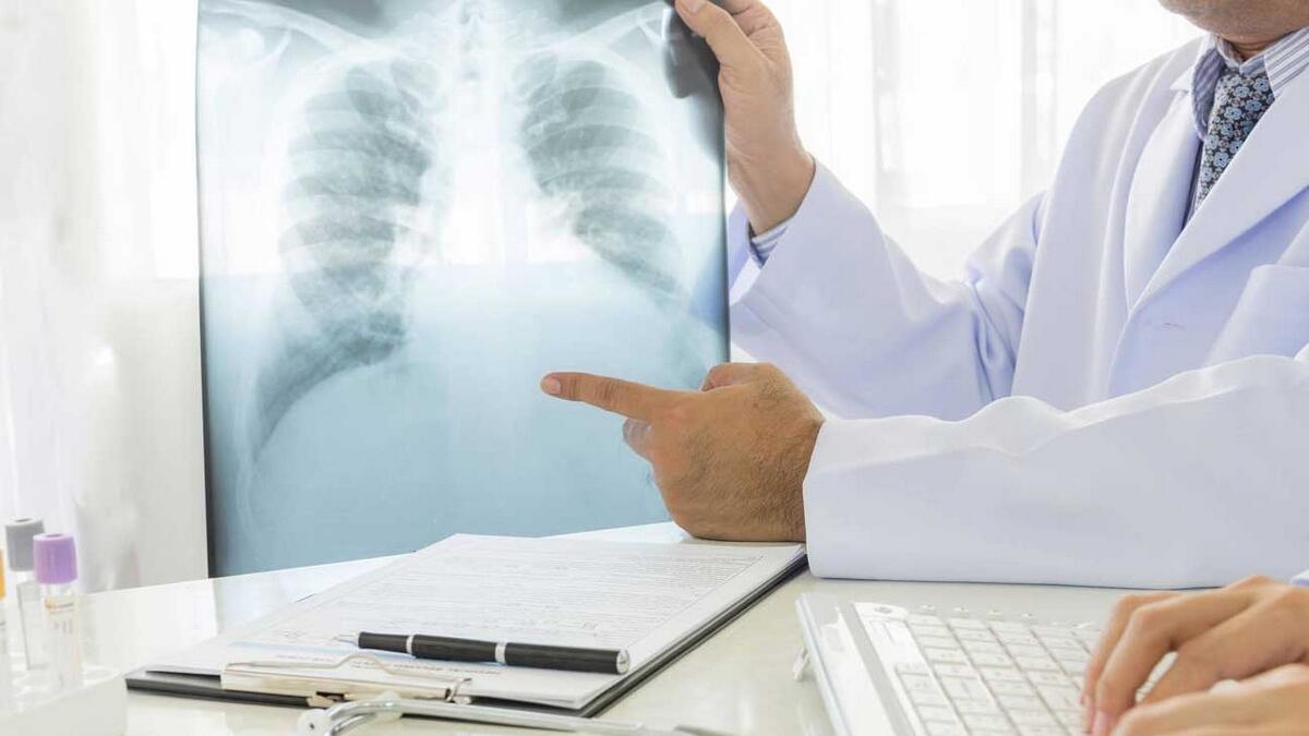 Dubai medical fitness X-Ray screening to take one second