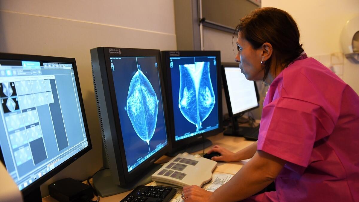 Google AI model beats humans in detecting breast cancer