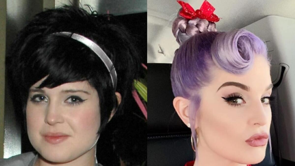 Kelly Osbourne, actor, gastric surgery, weight loss