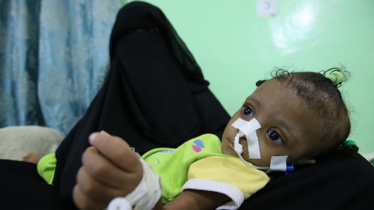 Kids bear brunt of Yemen conflict