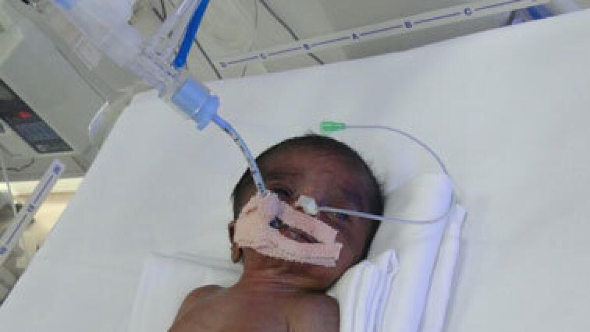 Mother seeks help for her baby’s treatment