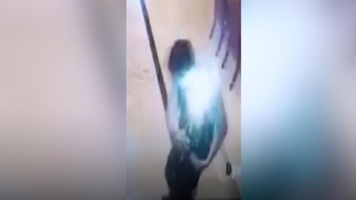 Mobile phone explodes in mans pocket and sets his shirt on fire