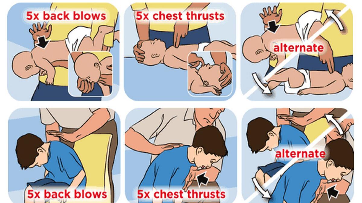 Choking kills more infants in summer, warn doctors