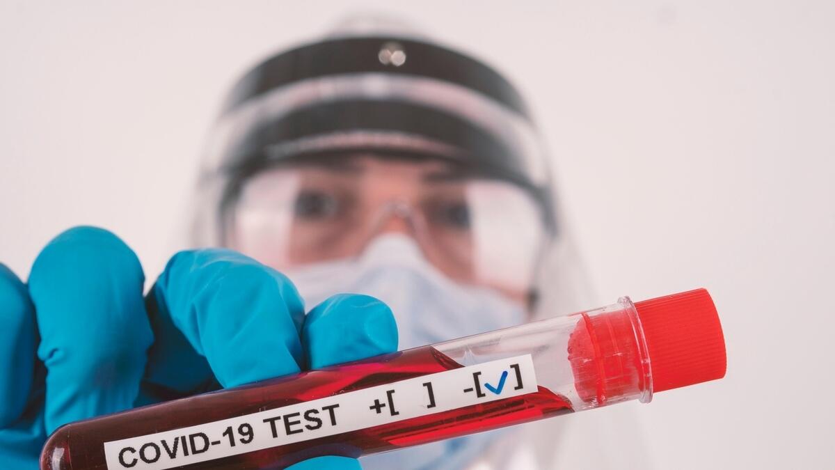 covid-19, coronavirus, forging covid test result