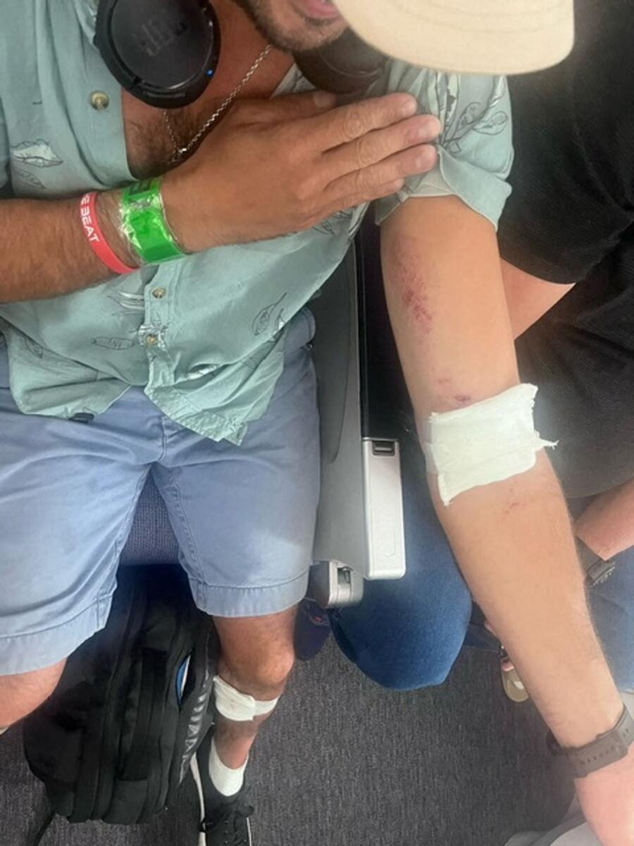 A passenger shows his injuries after the incident. — Reuters
