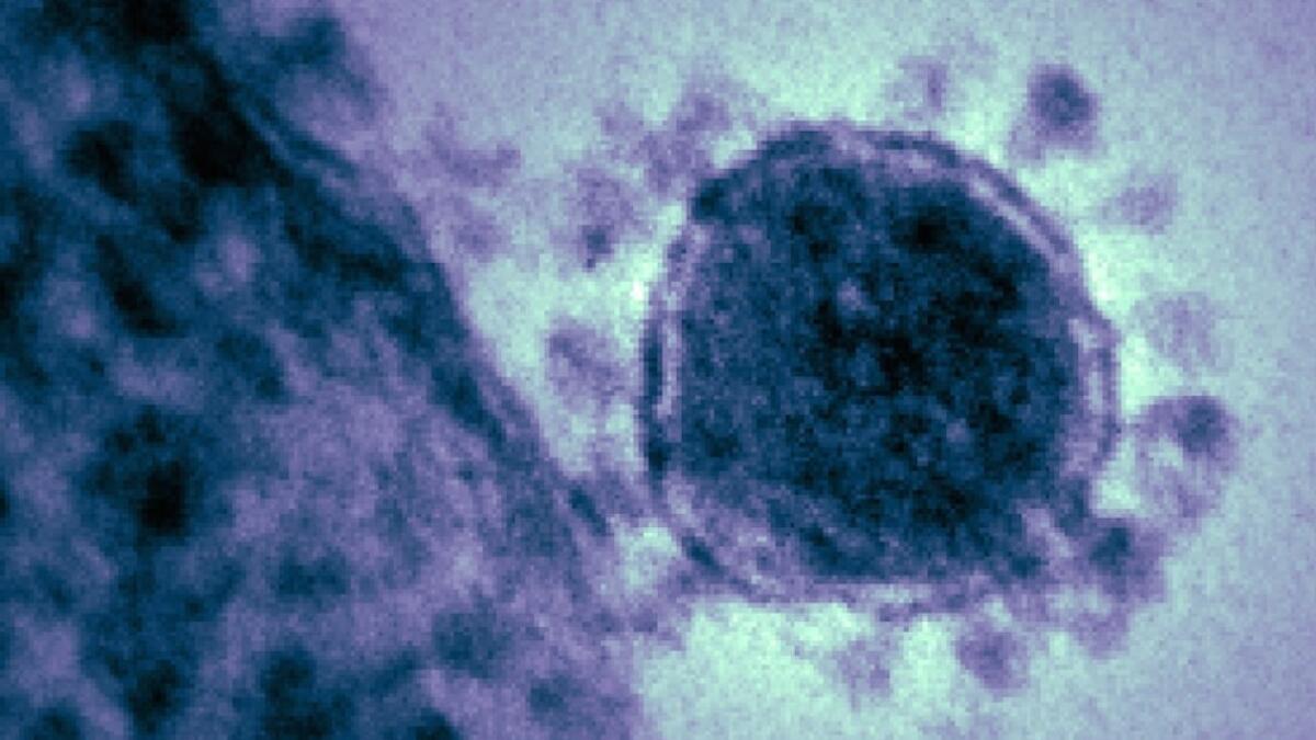 Saudi closes emergency ward after spike in MERS cases