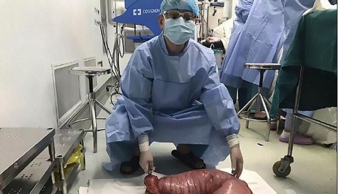 28 pounds of feces removed from man 
