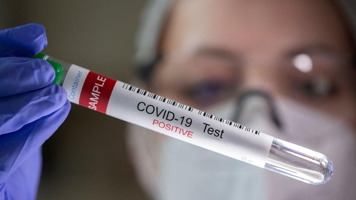 A test tube labelled Covid-19 test positive. Photo: Reuters