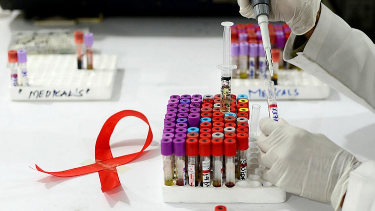 London HIV patient becomes worlds second Aids cure hope