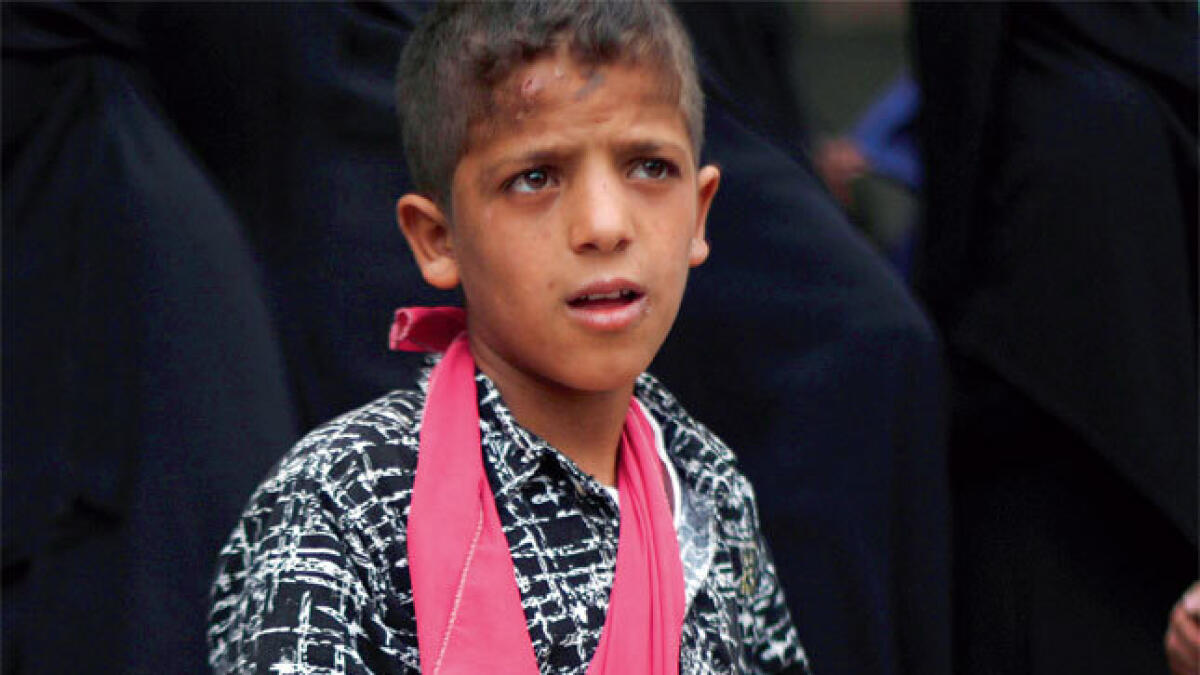 Yemen war taking toll on children