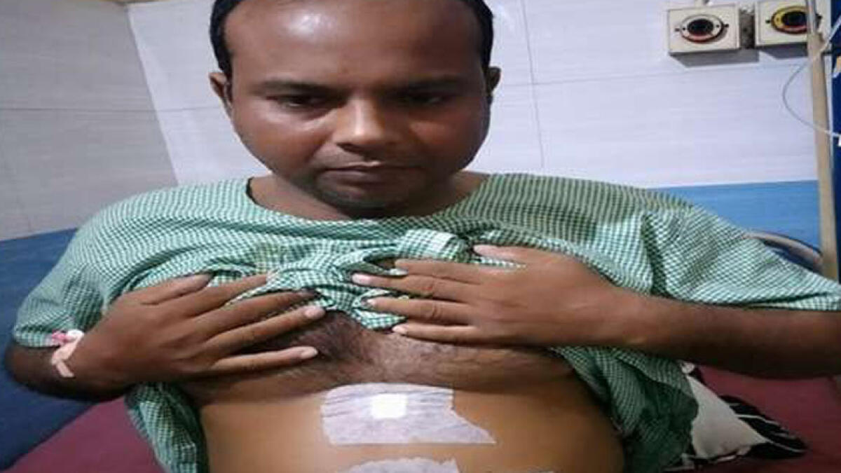 Indian, Jamaluddin, organs on wrong side