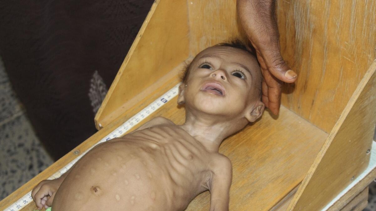 Yemen, UN, poverty, virus, children